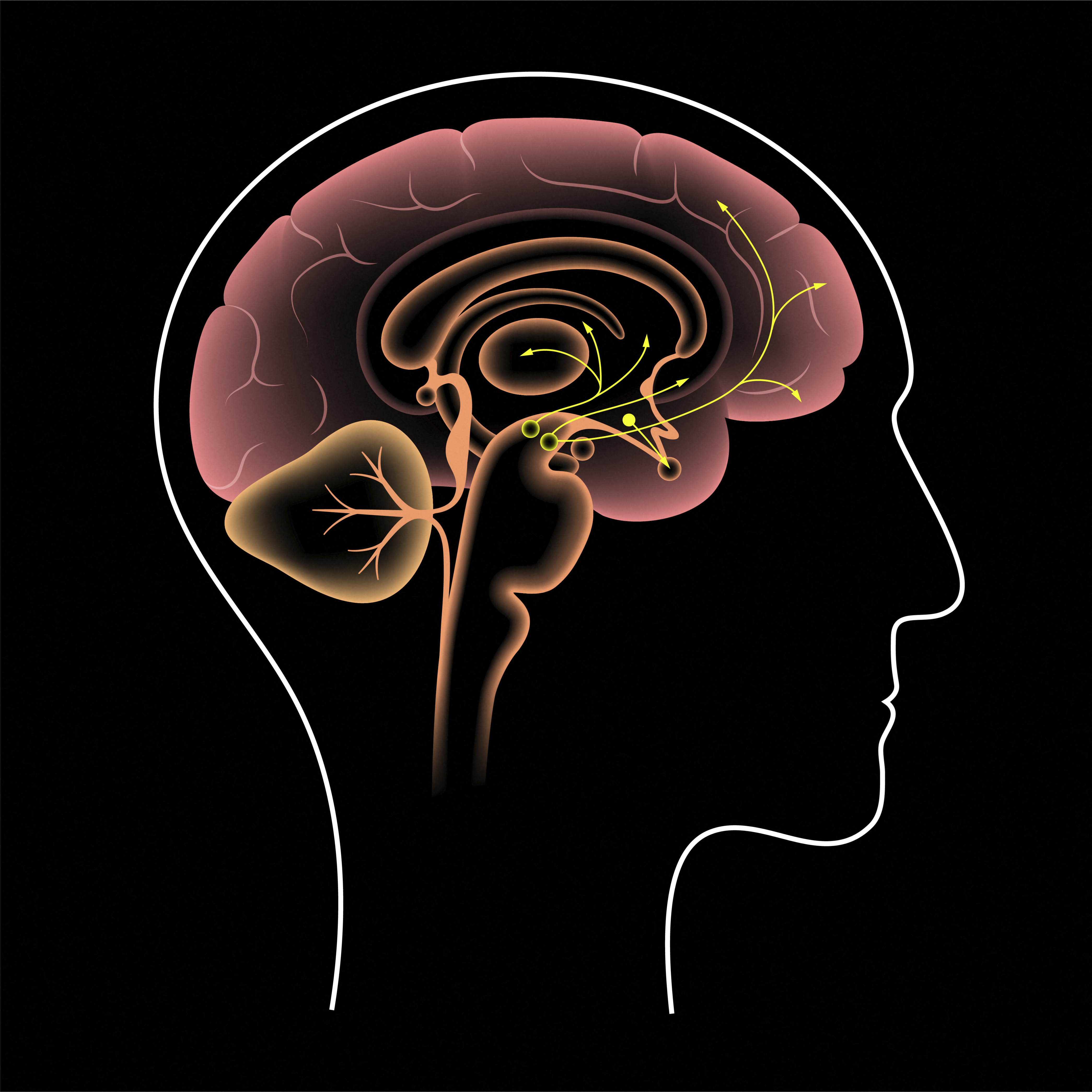 First Stem Cell Transplant for Parkinson's Disease Performed